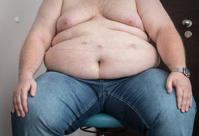
		Fettleibigkeit:  Immer mehr Menschen im Südwesten sind krankhaft übergewichtig
		