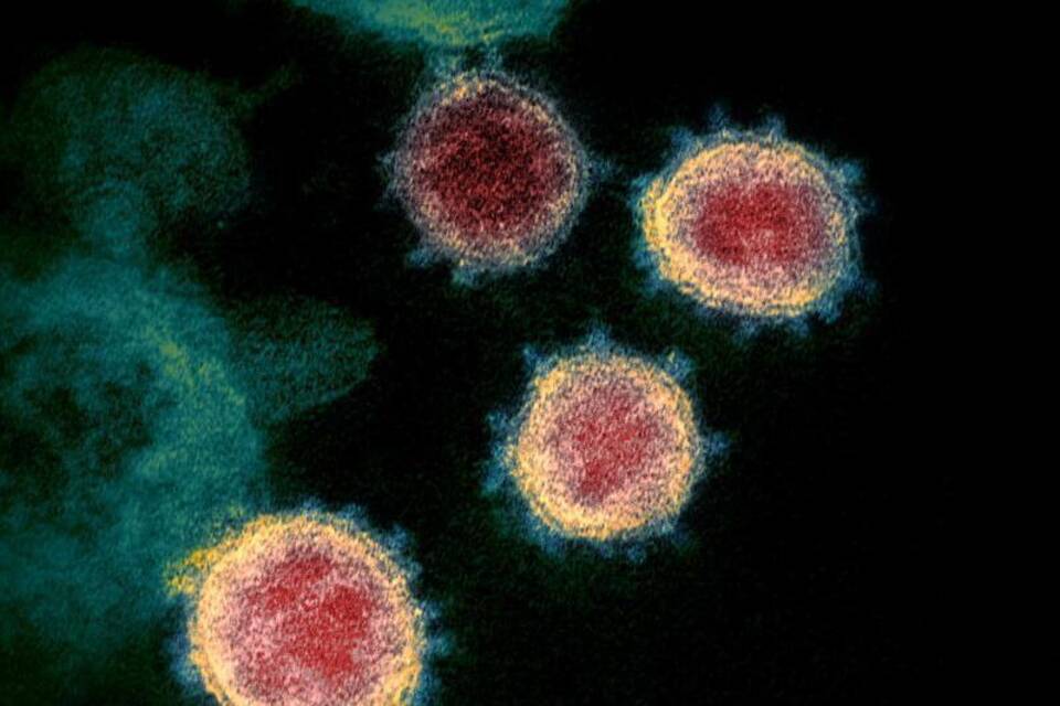 Virus SARS-CoV-2 Virus SARS-CoV-2
