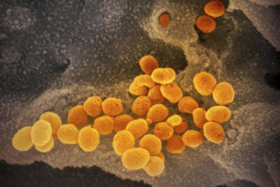Coronavirus Coronavirus