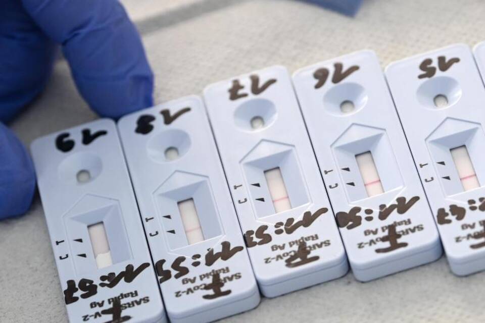Coronavirus - Tests Coronavirus - Tests