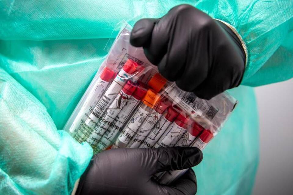 Proben für PCR-Tests