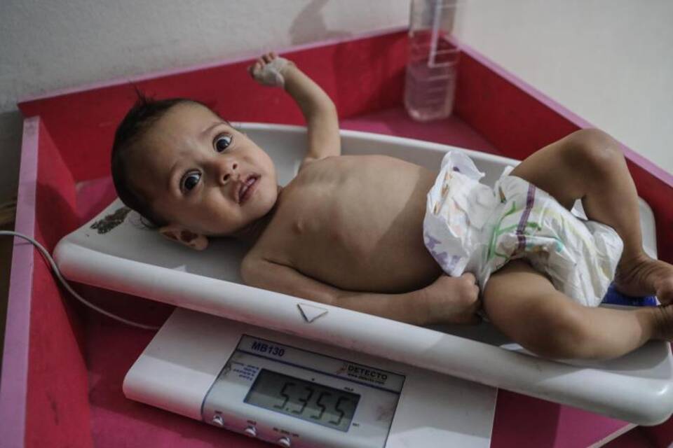 Unterernährte Kinder in Syrien Unterernährte Kinder in Syrien