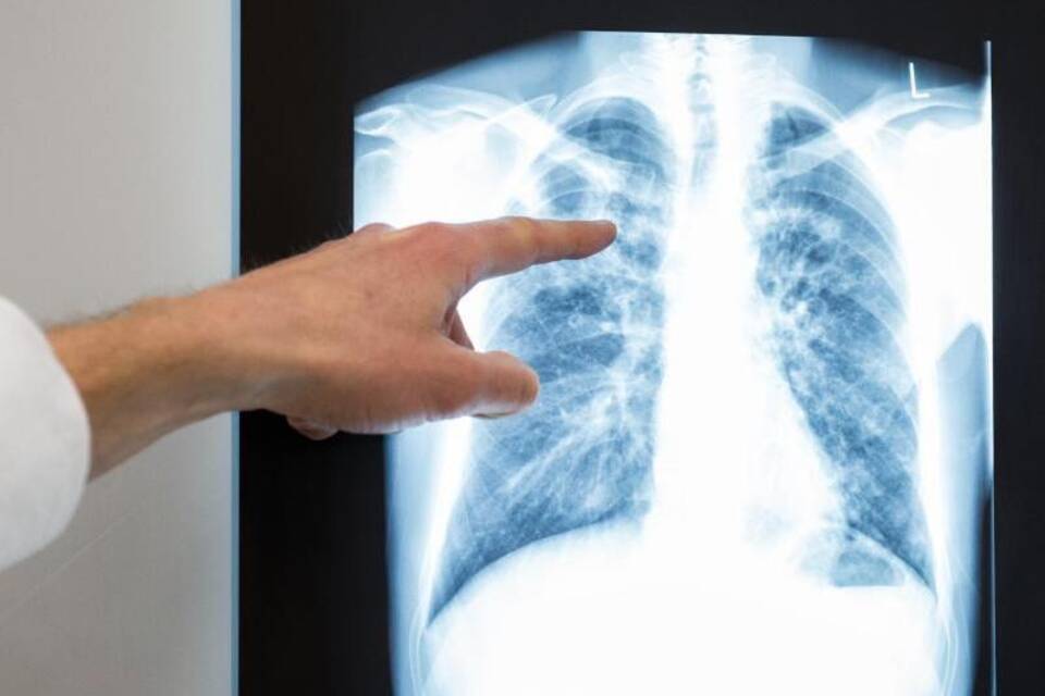 Tuberkulose Tuberkulose