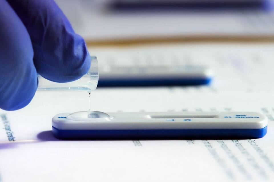 Die Testflüssigkeit eines Corona-Schnelltests wird ausgewertet Die Testflüssigkeit eines Corona-Schnelltests wird ausgewertet