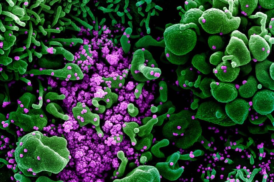Coronavirus Coronavirus