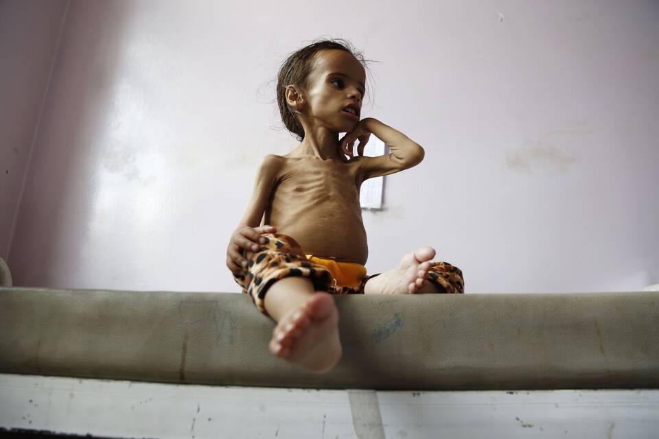 Hunger im Jemen
