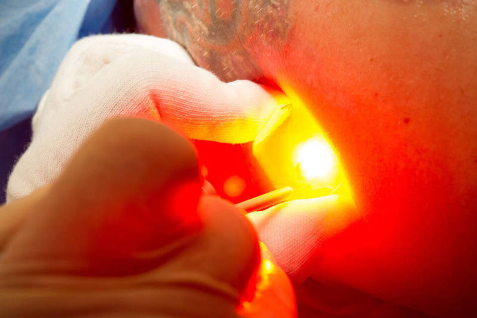 Endlich ohne Arschgeweih: Tattooentferner ist ein lukrativer Job Endlich ohne Arschgeweih: Tattooentferner ist ein lukrativer Job