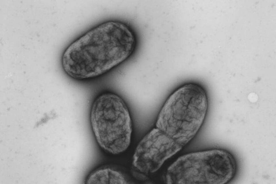 Yersinia pestis Yersinia pestis