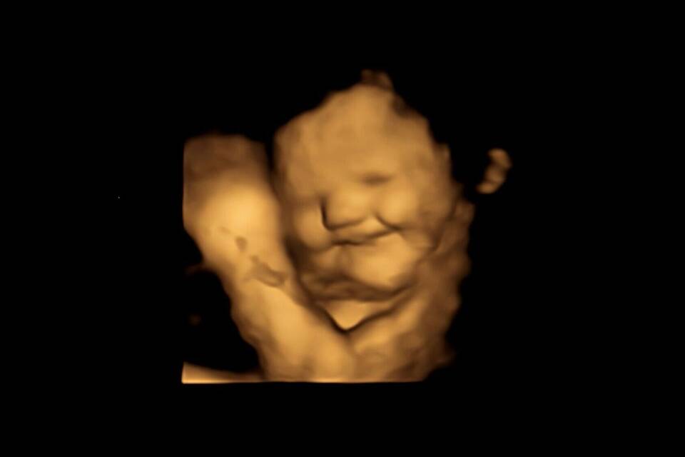 Baby im Bauch Baby im Bauch