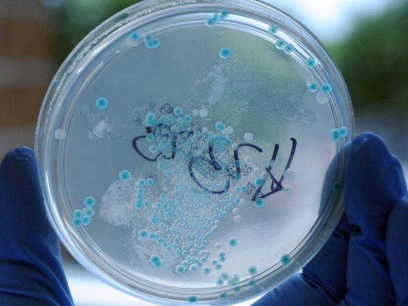 Darmbakterien beeinflussen womöglich Sättigungsgefühl Wissenschaft RNZ