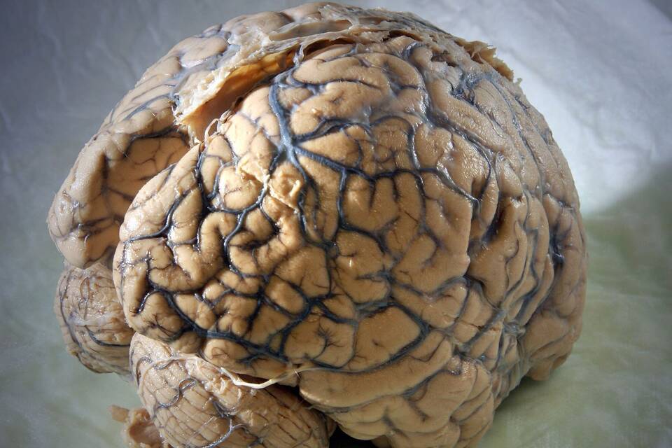 Menschliches Gehirn Menschliches Gehirn