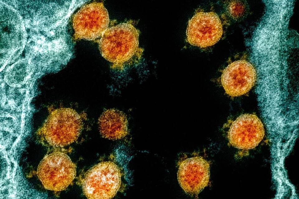 Coronavirus Coronavirus