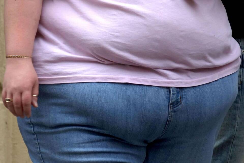Übergewicht sorgt in England für mehr Tote als Rauchen Übergewicht sorgt in England für mehr Tote als Rauchen