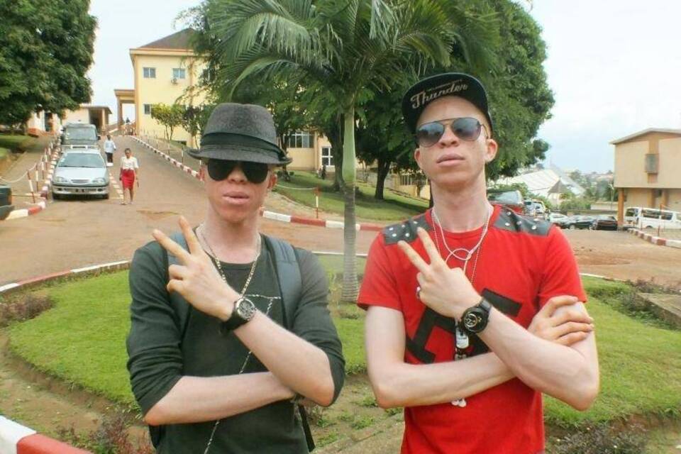 Albino-Rapper Albino-Rapper