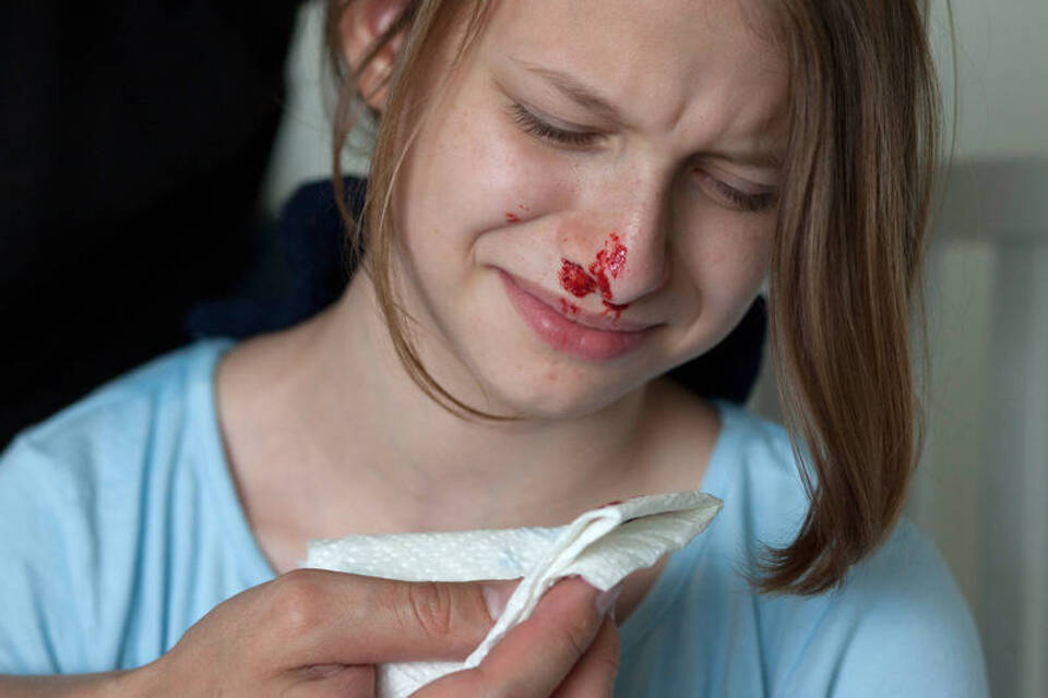 Ruhe bewahren und vorbeugen: Erste Hilfe bei Nasenbluten