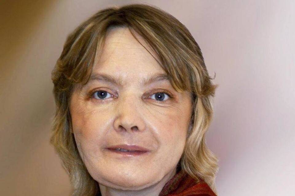 Isabelle Dinoire Isabelle Dinoire
