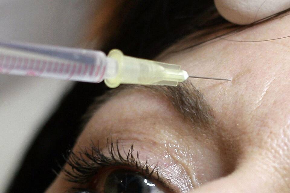 Botox Botox