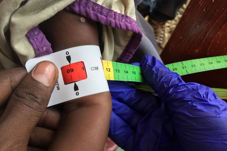 Unterenährte Kinder Unterenährte Kinder