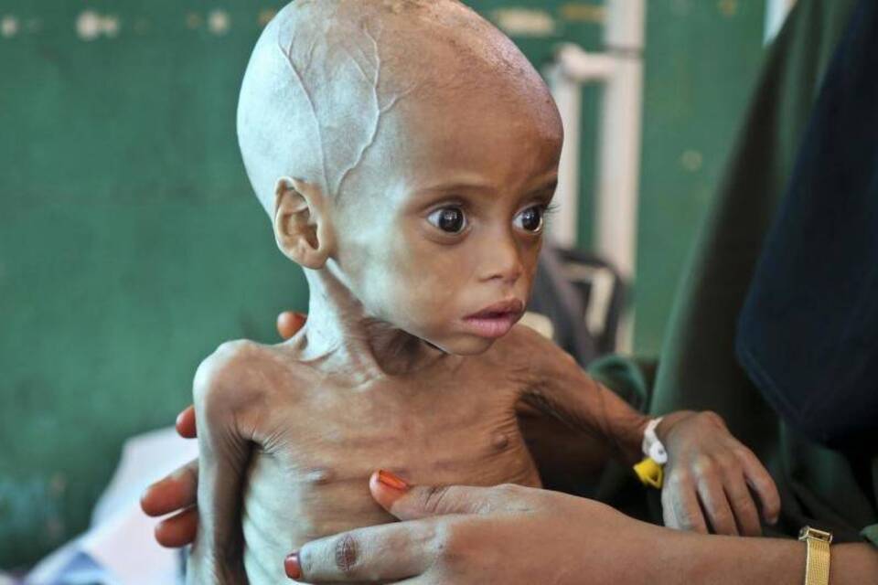 Hungersnot in Somalia Hungersnot in Somalia