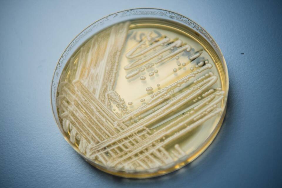 Krankenhaus-Pilz Candidozyma auris