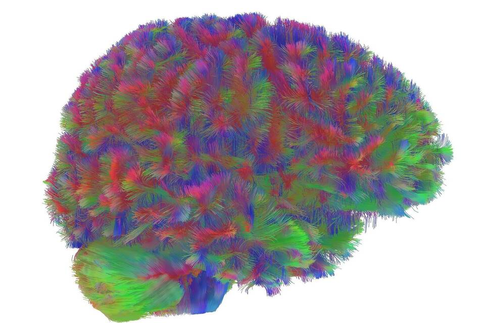 Kindheit bis Alter – Gehirnstruktur durchläuft fünf Phasen