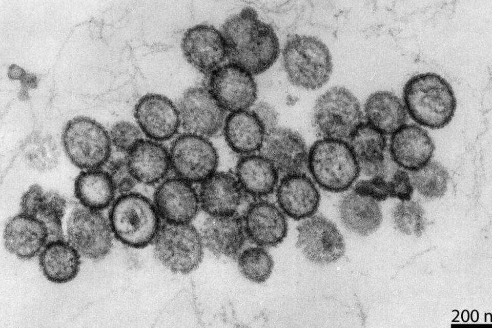 Hantavirus Hantavirus