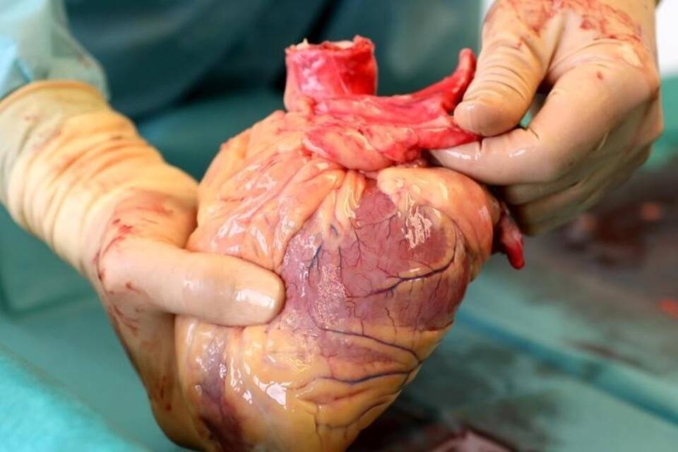 Organspende Organspende