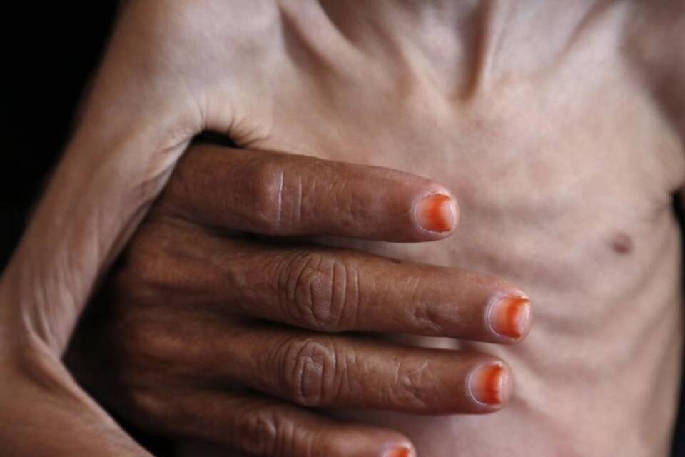 Humanitäre Krise im Jemen Humanitäre Krise im Jemen
