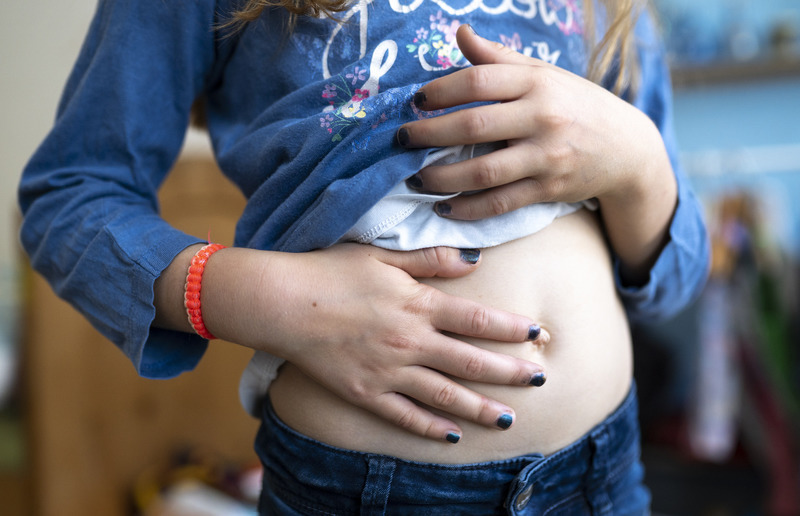 Appendizitis Blinddarmentzundung Bei Kindern Wann Muss Operiert