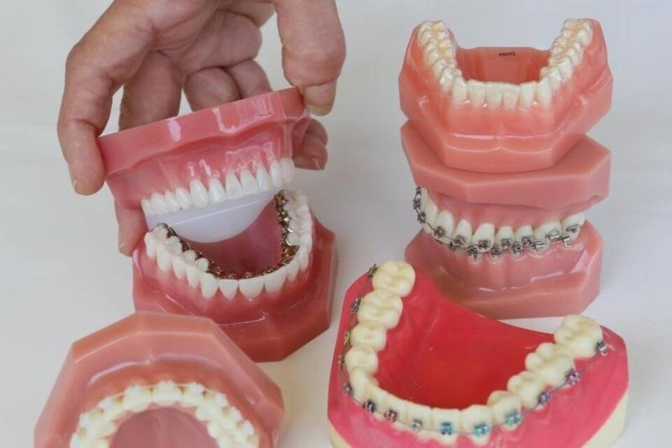 Zahnspangen