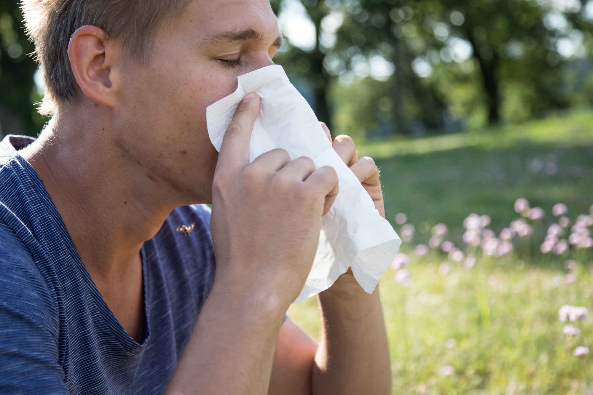 Heuschnupfen: Niesend durch den Frühling - Gesundheit - RNZ