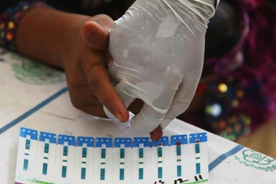 HIV-Test HIV-Test