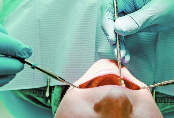 was übernimmt die krankenkasse beim zahnarzt