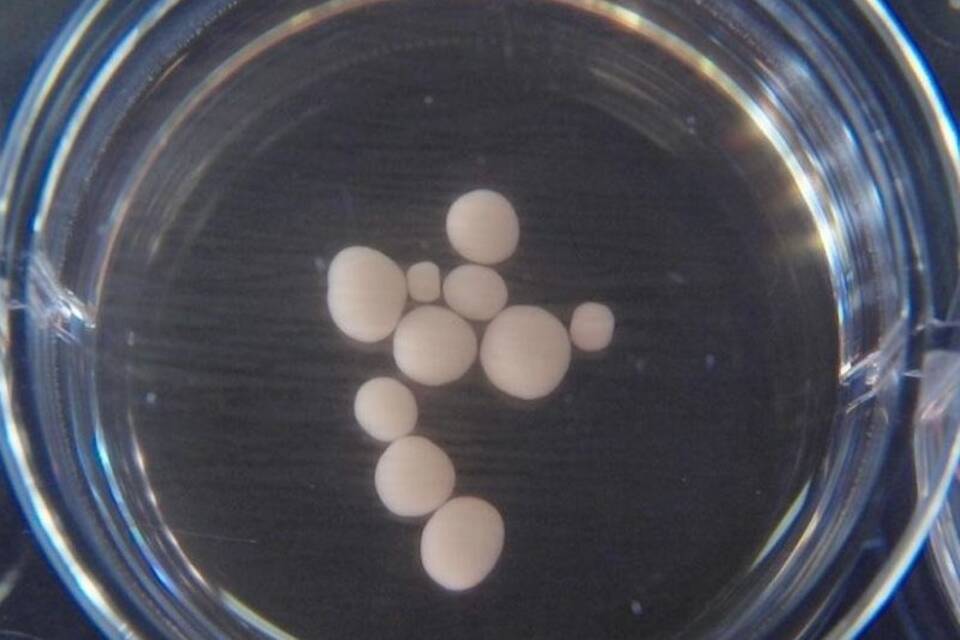 Elektrische Aktivität in Miniatur-Gehirnen Elektrische Aktivität in Miniatur-Gehirnen