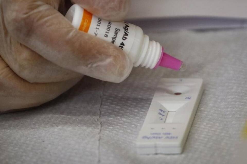 HIV-Test HIV-Test