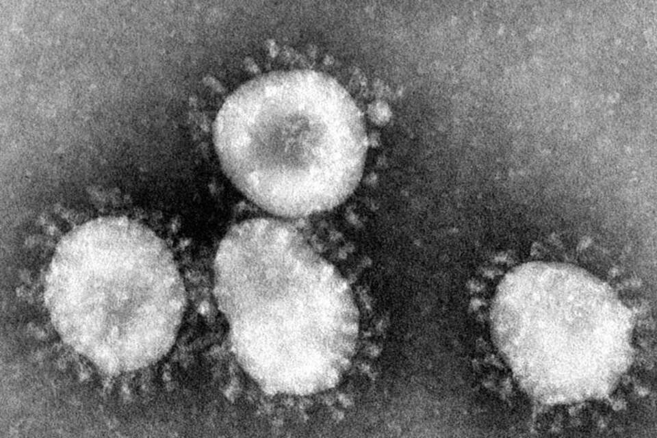 Coronavirus Coronavirus