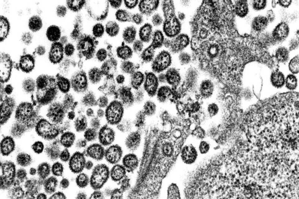 Lassavirus Lassavirus