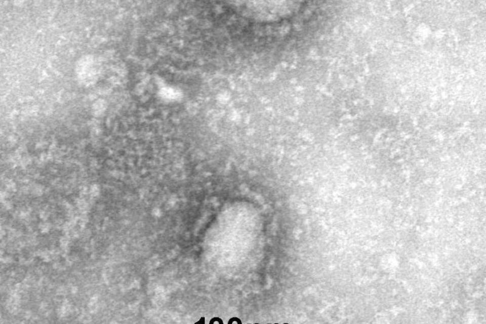 Coronavirus Coronavirus
