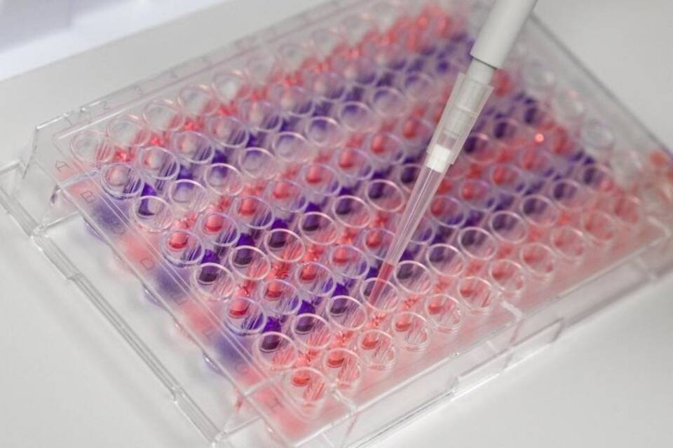 Untersuchungen zum Coronavirus Untersuchungen zum Coronavirus