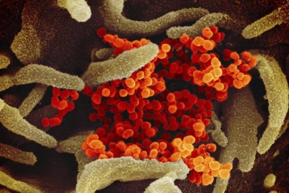 Coronavirus Coronavirus
