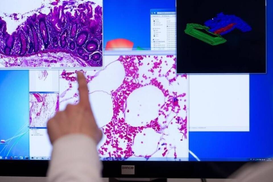 Krebsdiagnostik Krebsdiagnostik