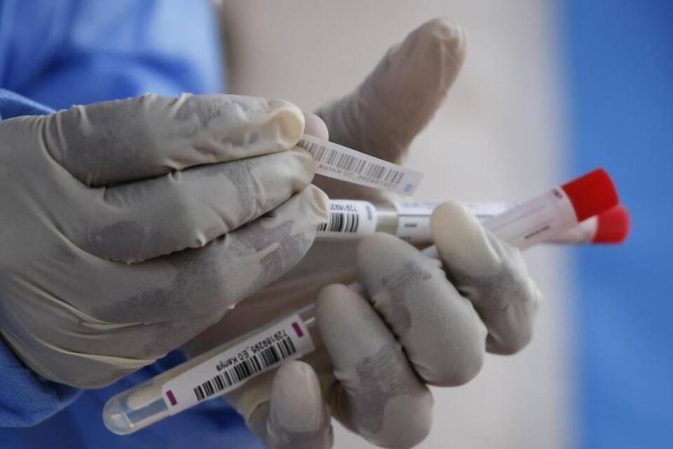 Coronavirus-Tests Coronavirus-Tests