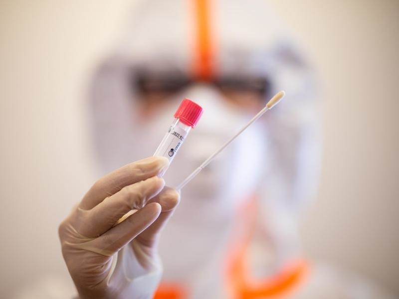 Theoretische Zahl Heinsberg Studie Moglicherweise 1 8 Millionen Infizierte Wissenschaft Rnz