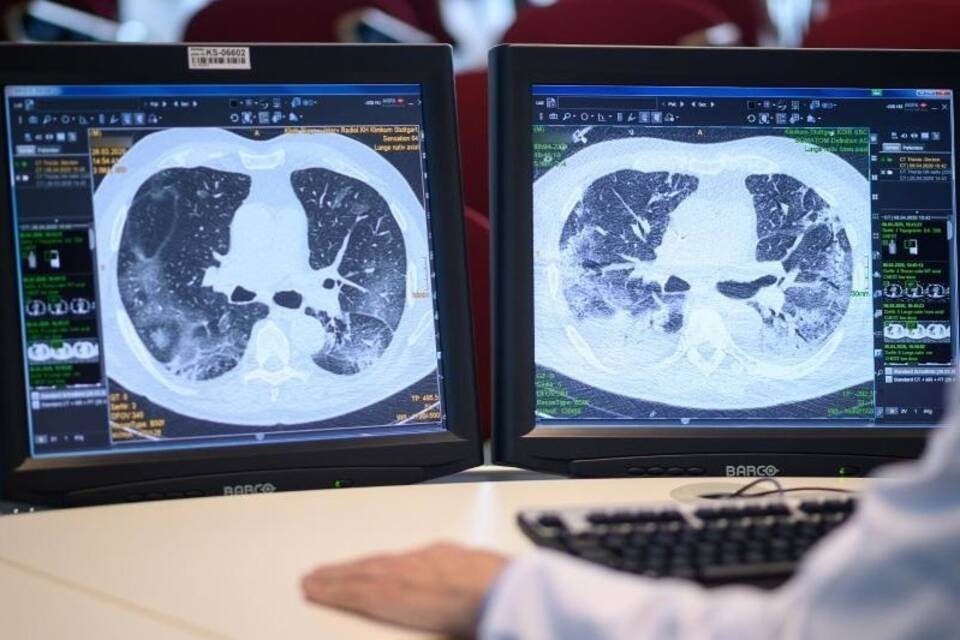 Wie es Patienten nach Covid-19 geht Wie es Patienten nach Covid-19 geht