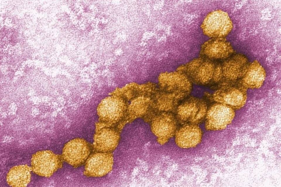 West-Nil-Virus West-Nil-Virus