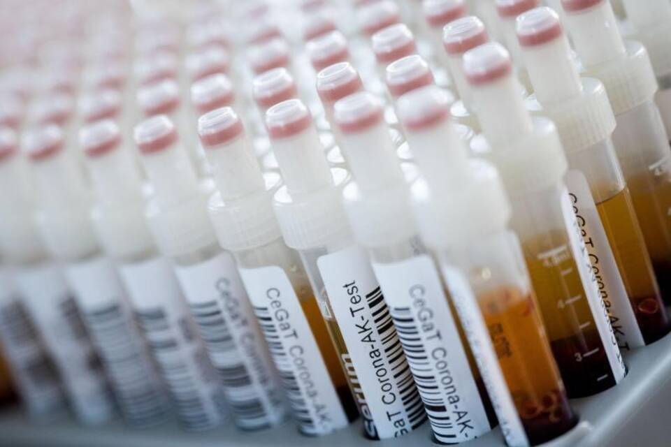 Corona-Antikörper-Test Corona-Antikörper-Test